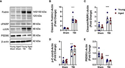 Traumatic Brain Injury Induces cGAS Activation and Type I Interferon Signaling in Aged Mice